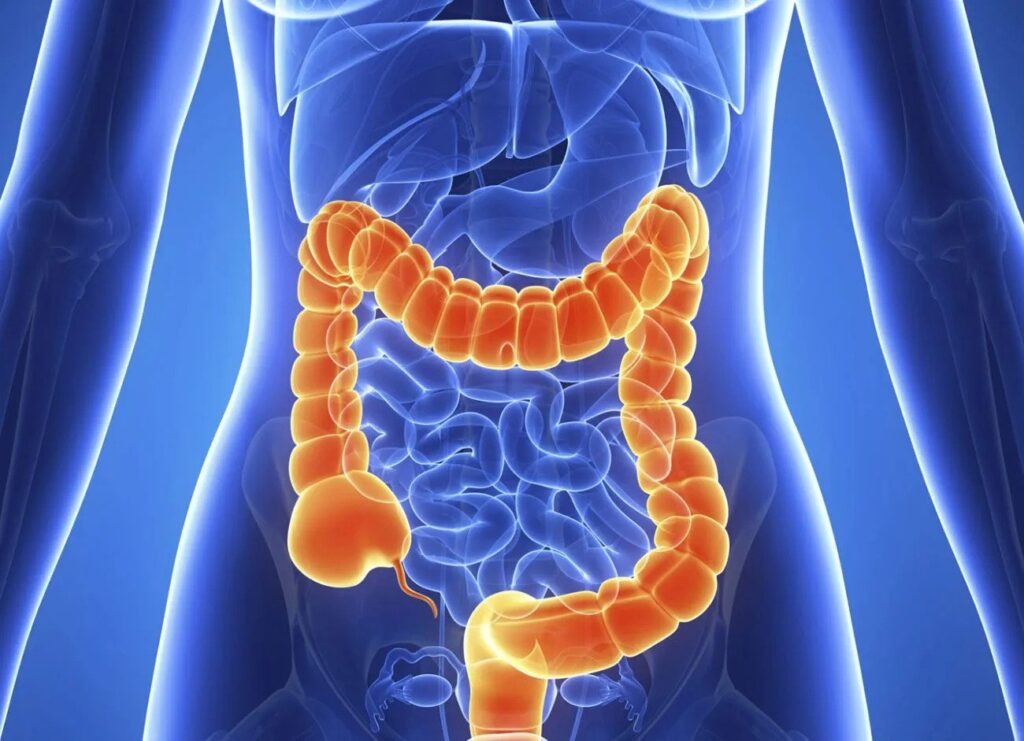 Colorectal Cancer: Awareness,Attention & Prevention