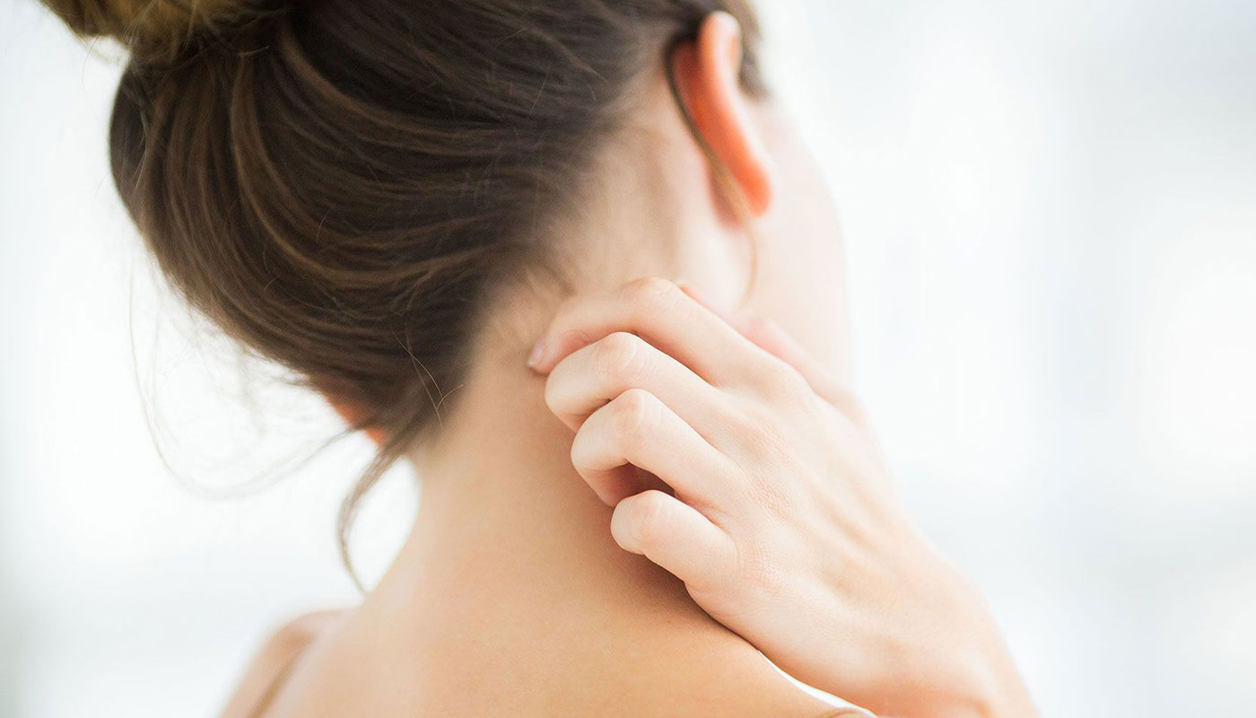 How Is Contact Dermatitis Treated?