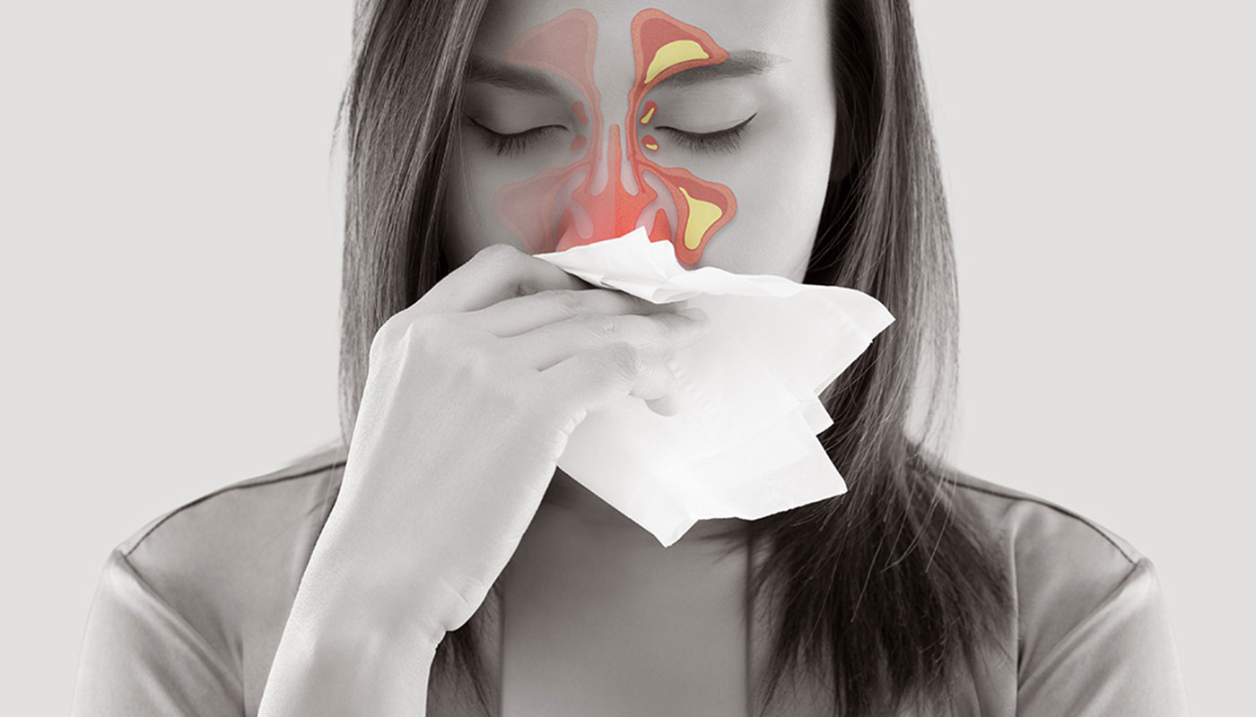 Symptoms Of Sinusitis