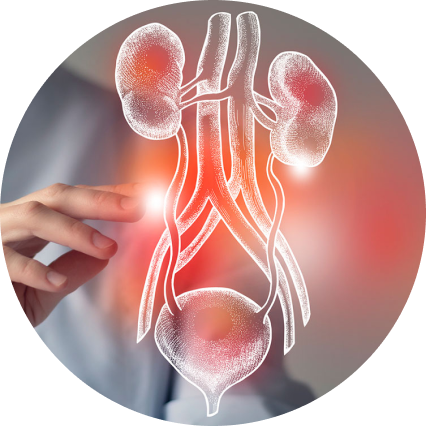 Urinary Tract Infection